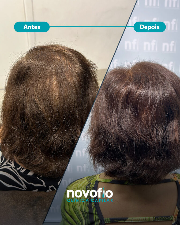 20._antes-e-depois-IRACEMA4