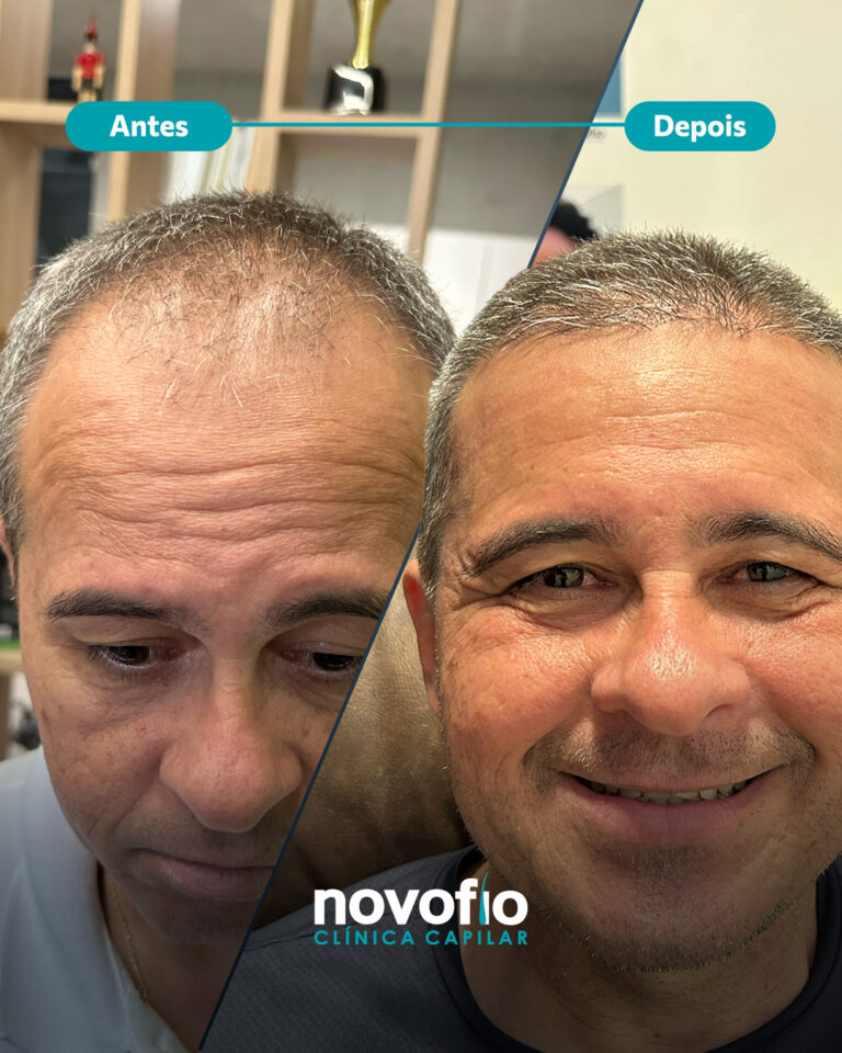 21._antes-e-depois-IVALDO2